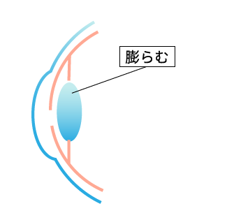 膨らむ