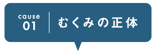 cause1 むくみの正体